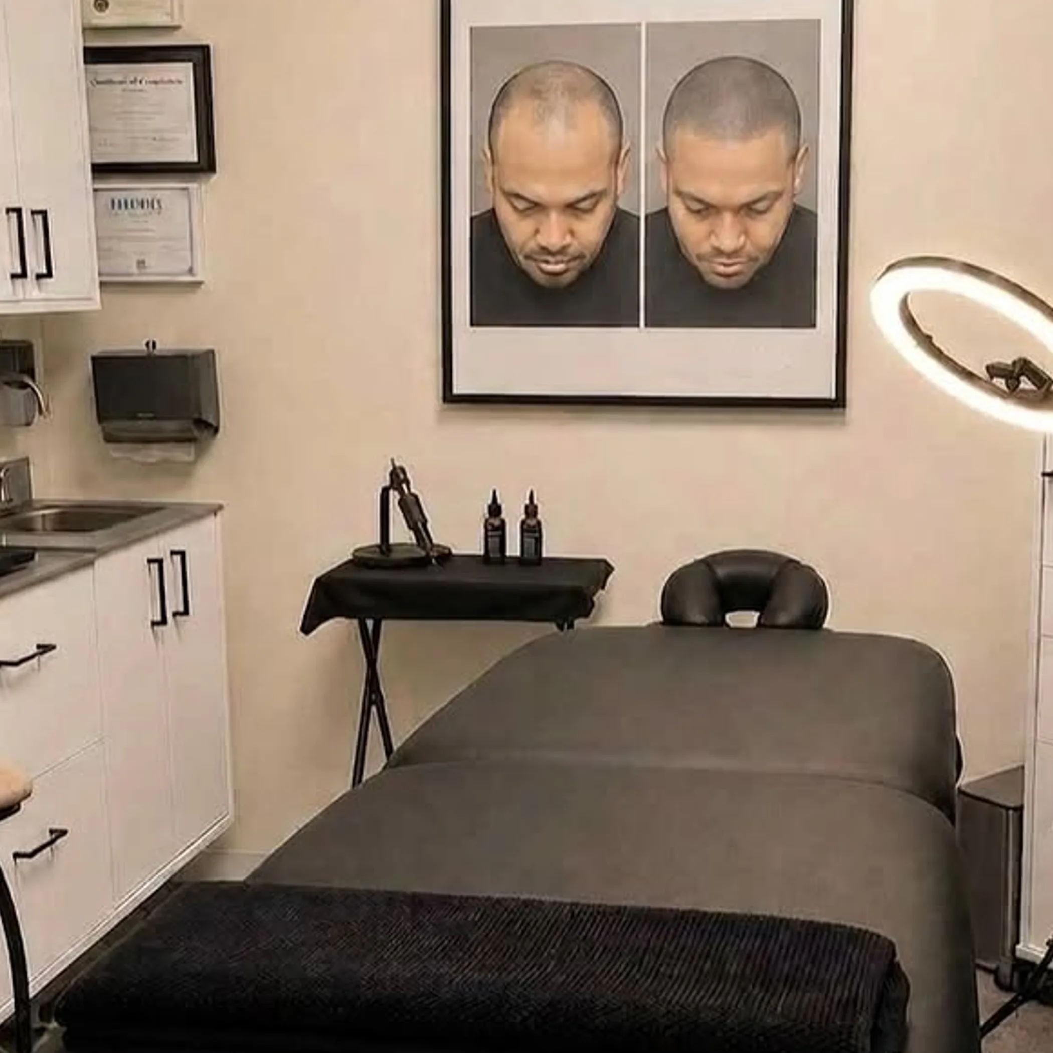 scalp micropigmentation procedure close-up